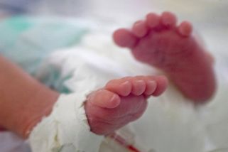 Ženu při porodu na Bulovce omylem zapálili. První reakce nemocnice